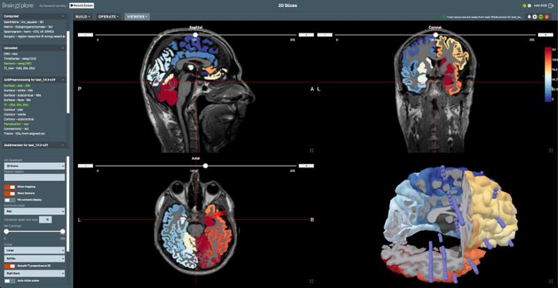 BrainXplore_cover.jpg