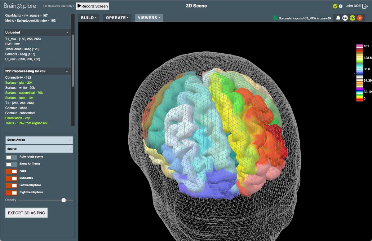 Sample of BrainXplore UI