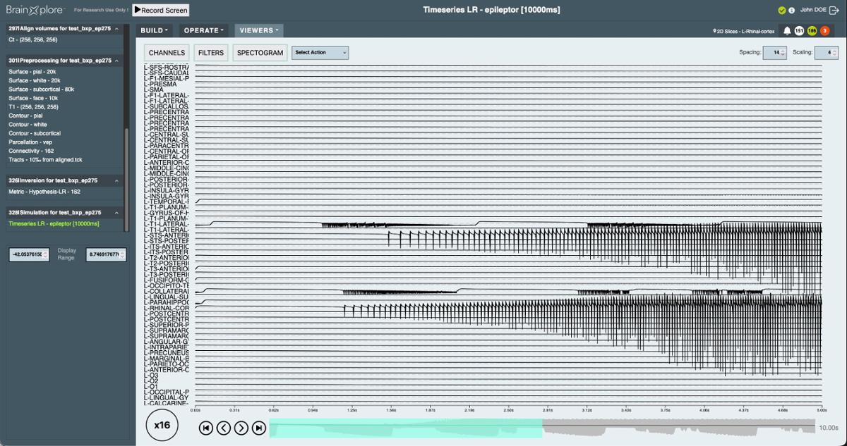 Sample of BrainXplore UI