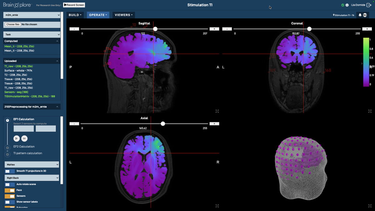 Sample of BrainXplore UI